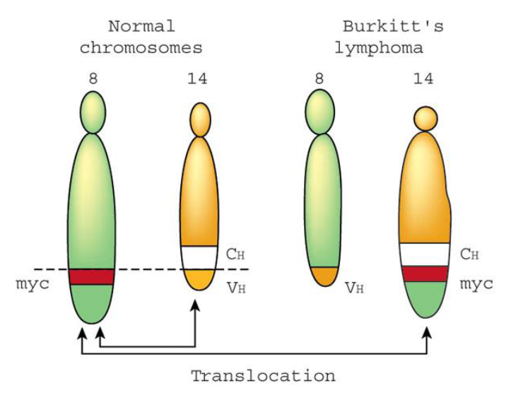 <p>Burkitt’s lymphoma&nbsp;</p>