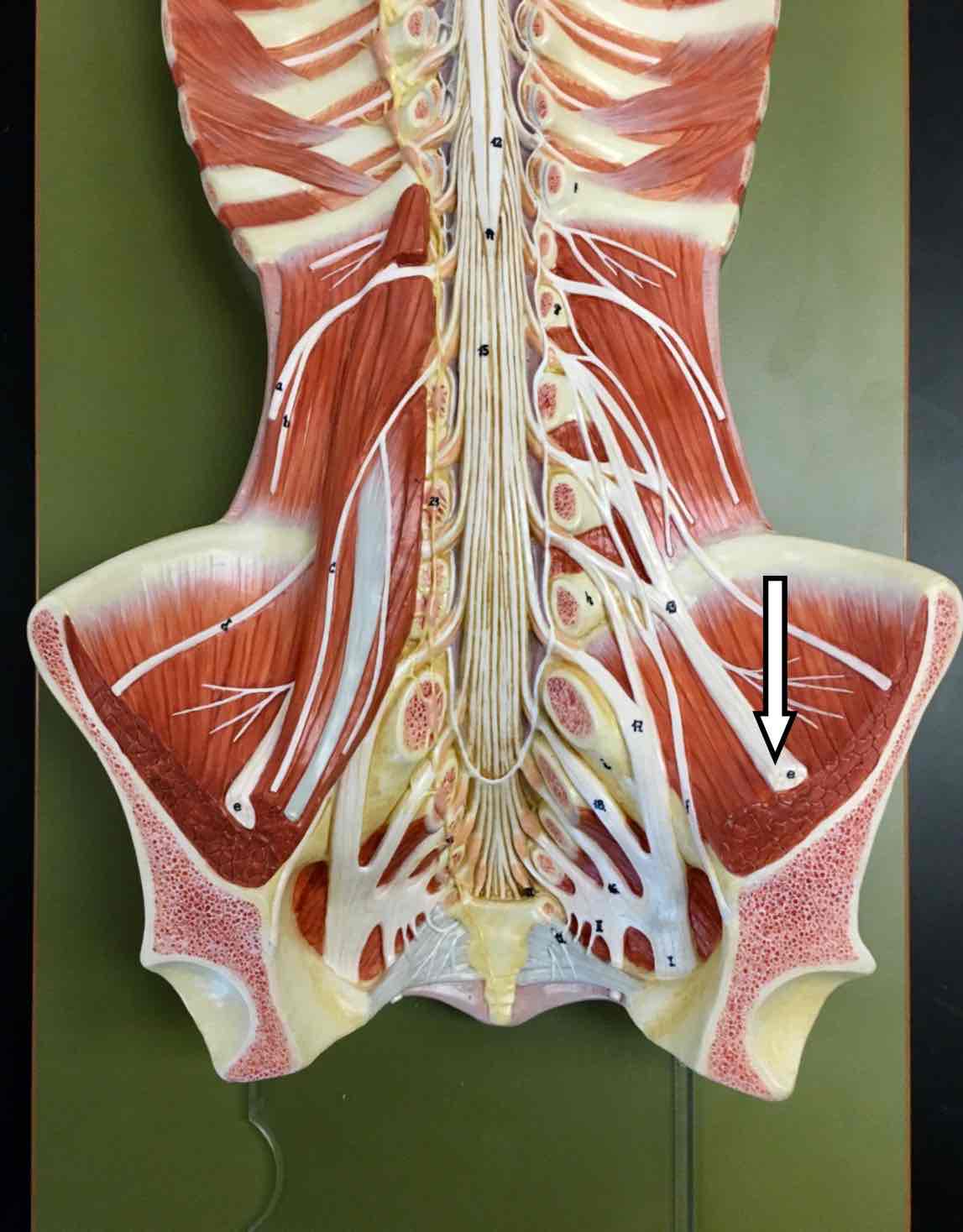 <p>name the specific white structure</p>