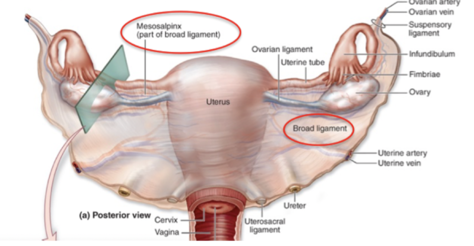 <p>Det breda ligamentet är en en del <strong>peritoneum</strong>. </p><ul><li><p>Mesoalpinx</p></li><li><p>Mesovarium</p></li><li><p>Mesometrium</p></li></ul>