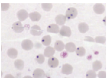 <p>What is this parasite</p>