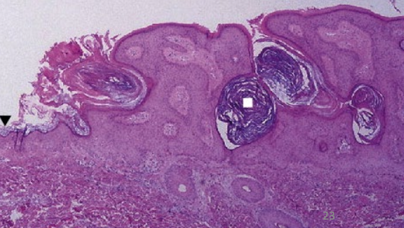 term image
