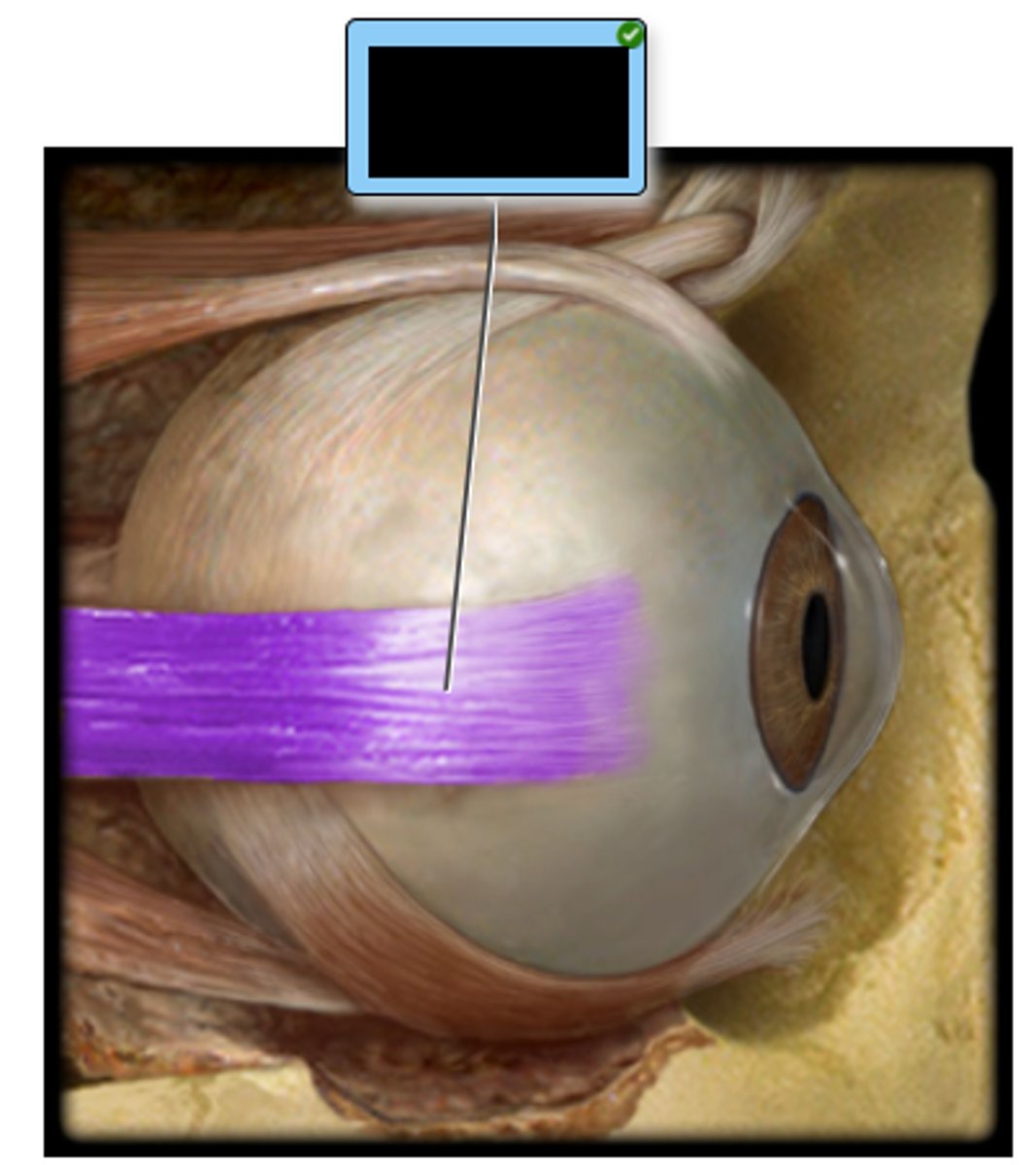 <p>Indicate the action of the highlighted muscle of the eye.</p><p>a. Abduction of eyeball</p><p>b. Dilation of pupil</p><p>c. Elevation of eyeball</p><p>d. Adduction of eyeball</p><p>e. Depression of eyeball</p>