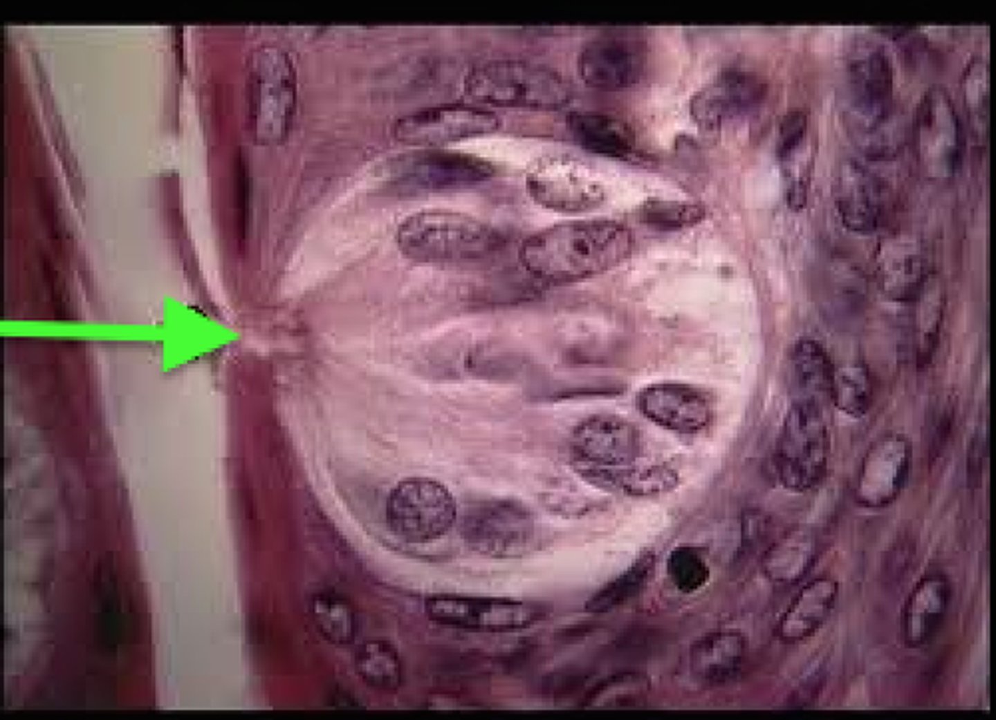 <p>Labeling parts of the Taste Cell.</p><p>Opening in the surface end of taste bud where cilia is extended into from receptor cells to contact tastants (substances that can be tasted).</p>