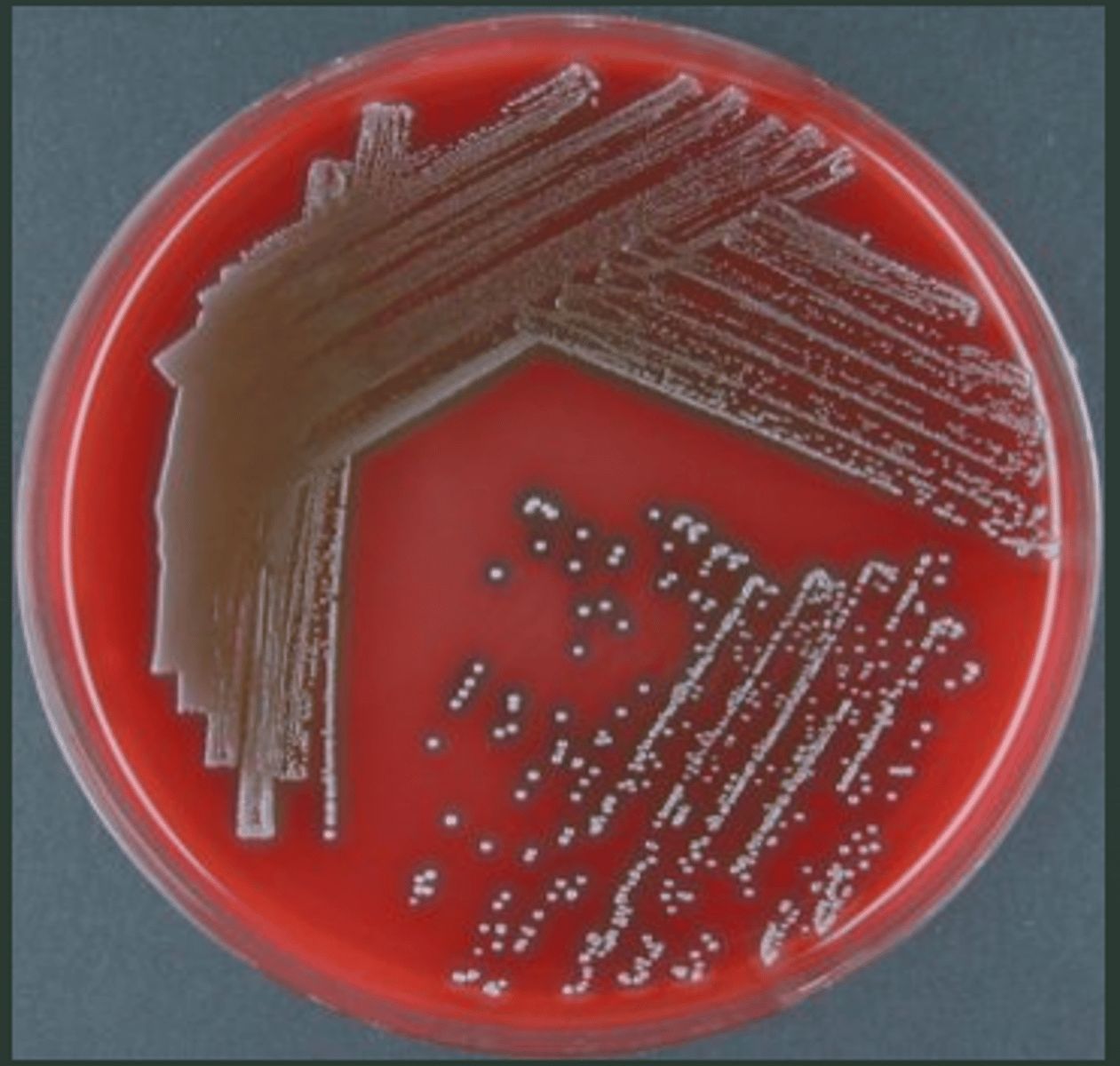 <p>identify what type of hemolytic activity</p>