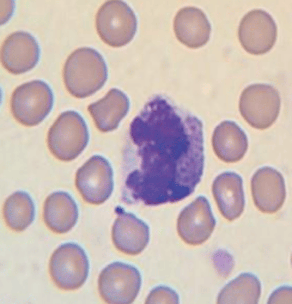 <p>what leukocyte is this?</p>