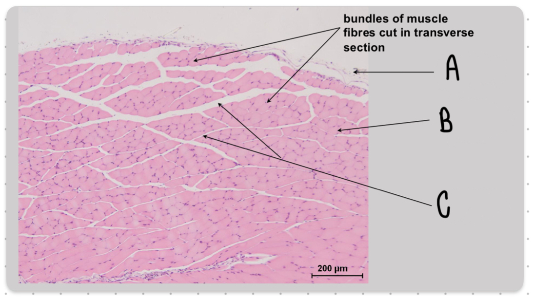 <p>What is the structure labeled A in this image?</p>