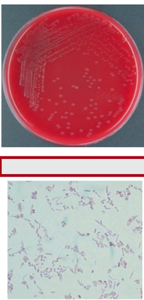 <p>BA and MAC cultures from the kidney of a 4 day-old foal which died suddenly are provided. A Gram stained-smear prepared from colony material is also provided. On post- mortem examination, there were multiple microabscesses in the kidneys.</p><p>NO growth on MAC</p><p>Examine plates and Gram stain/microscopic morphology. Record the identification of this</p><p>equine pathogen.</p>