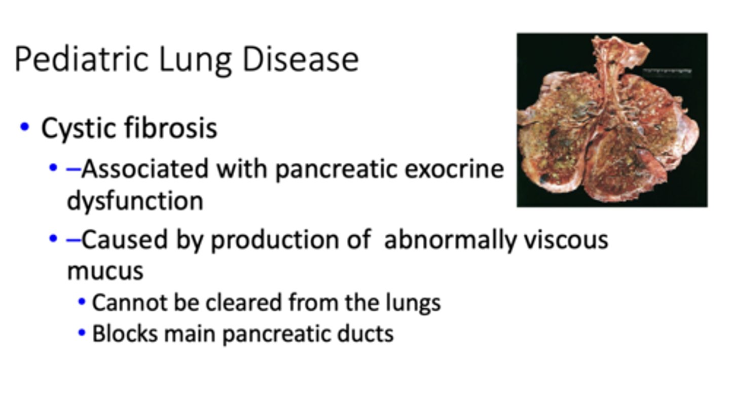 <p>Cystic fibrosis</p>