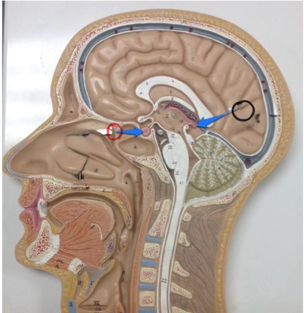 <p>What structure is the red circle</p>