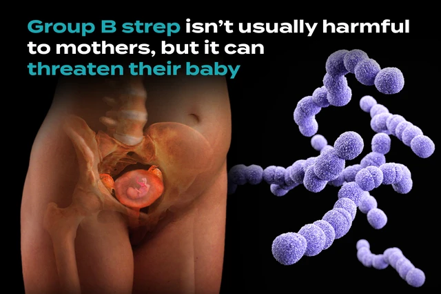 <p>What is <strong><em>Streptococcus agalactiae?</em></strong></p>