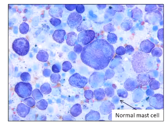 <p>variation in cell size</p><ul><li><p>Iso = equal</p></li><li><p>Aniso = not equal</p></li><li><p>Cyto = Cell</p></li></ul><p></p>