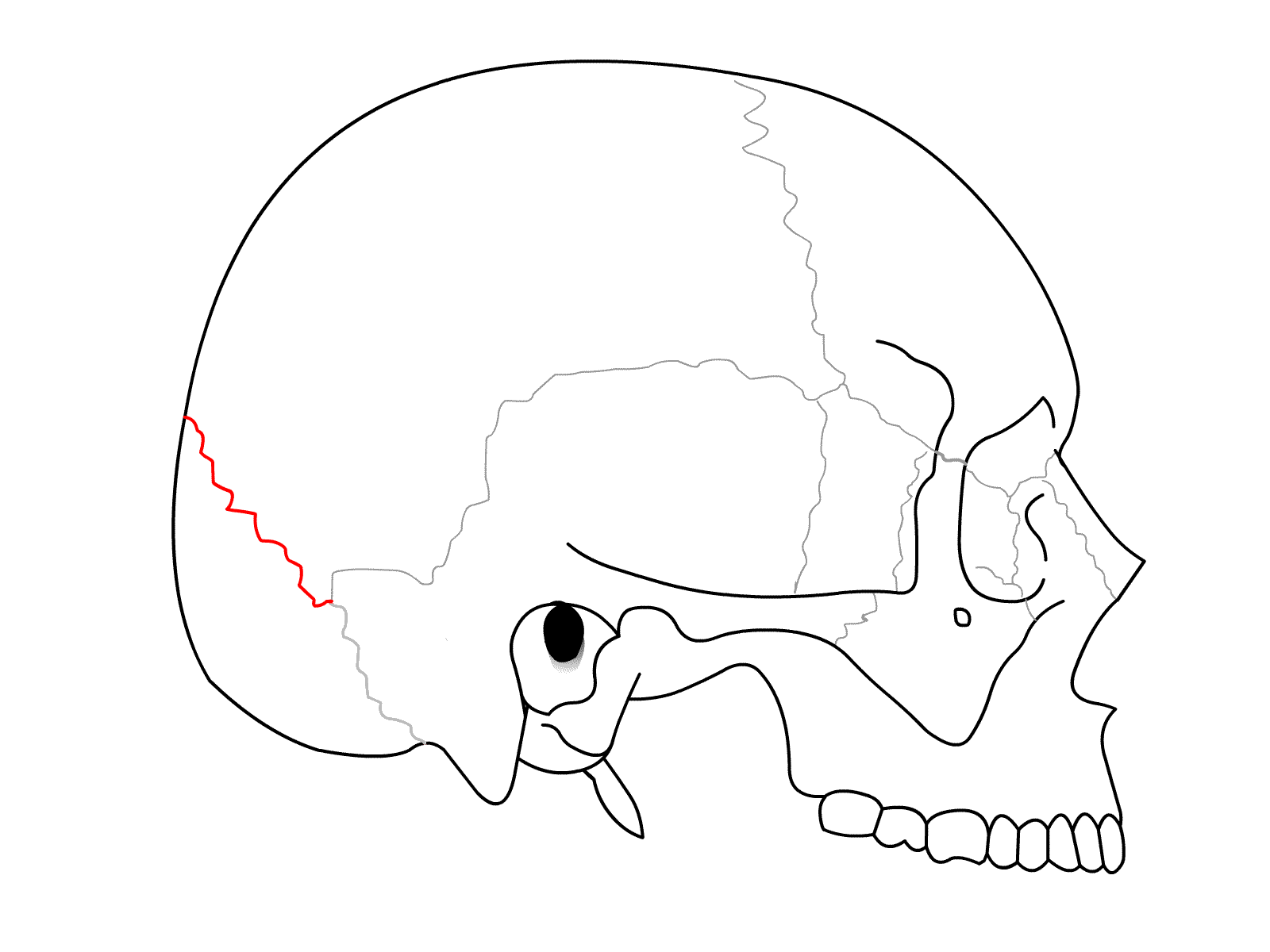 <p>lambdoid suture (lateral view)</p>