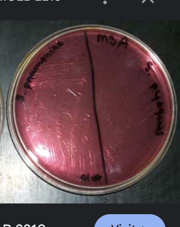 <p>What color if MSA is negative&nbsp;</p>