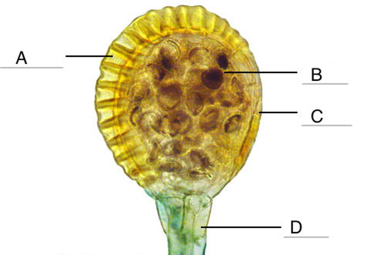 <p>Structure D</p><p>sporangial body and stalk in Leptosporangium</p>