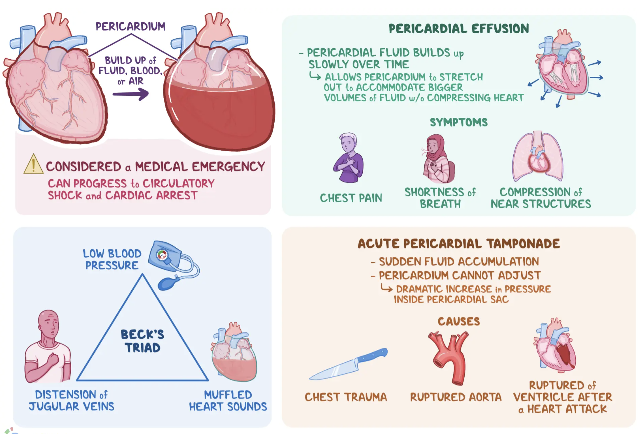 <ul><li><p><span style="background-color: transparent;"><strong>Pericardial effusion:</strong> Fluid accumulation in the pericardial sac (normally <50 mL).</span></p></li><li><p><span style="background-color: transparent;"><strong>Cardiac tamponade:</strong> Life-threatening compression of the heart due to rapid or excessive effusion → decreased cardiac output (CO).</span></p></li></ul><p><span style="font-family: "Times New Roman", serif;">Accumulation of fluid in the pericardial sac</span></p><p><span style="font-family: "Times New Roman", serif;">Increase pericardial fluid raises pressure in the sac and comprises the heart</span></p><p><span style="font-family: "Times New Roman", serif;">Leads to decreased venous return</span></p><p><span style="font-family: "Times New Roman", serif;">Inability of ventricles to distend and fill adequately</span></p><p><span style="font-family: "Times New Roman", serif; line-height: 115%;">Increased right and left ventricular end-diastolic pressure</span></p>