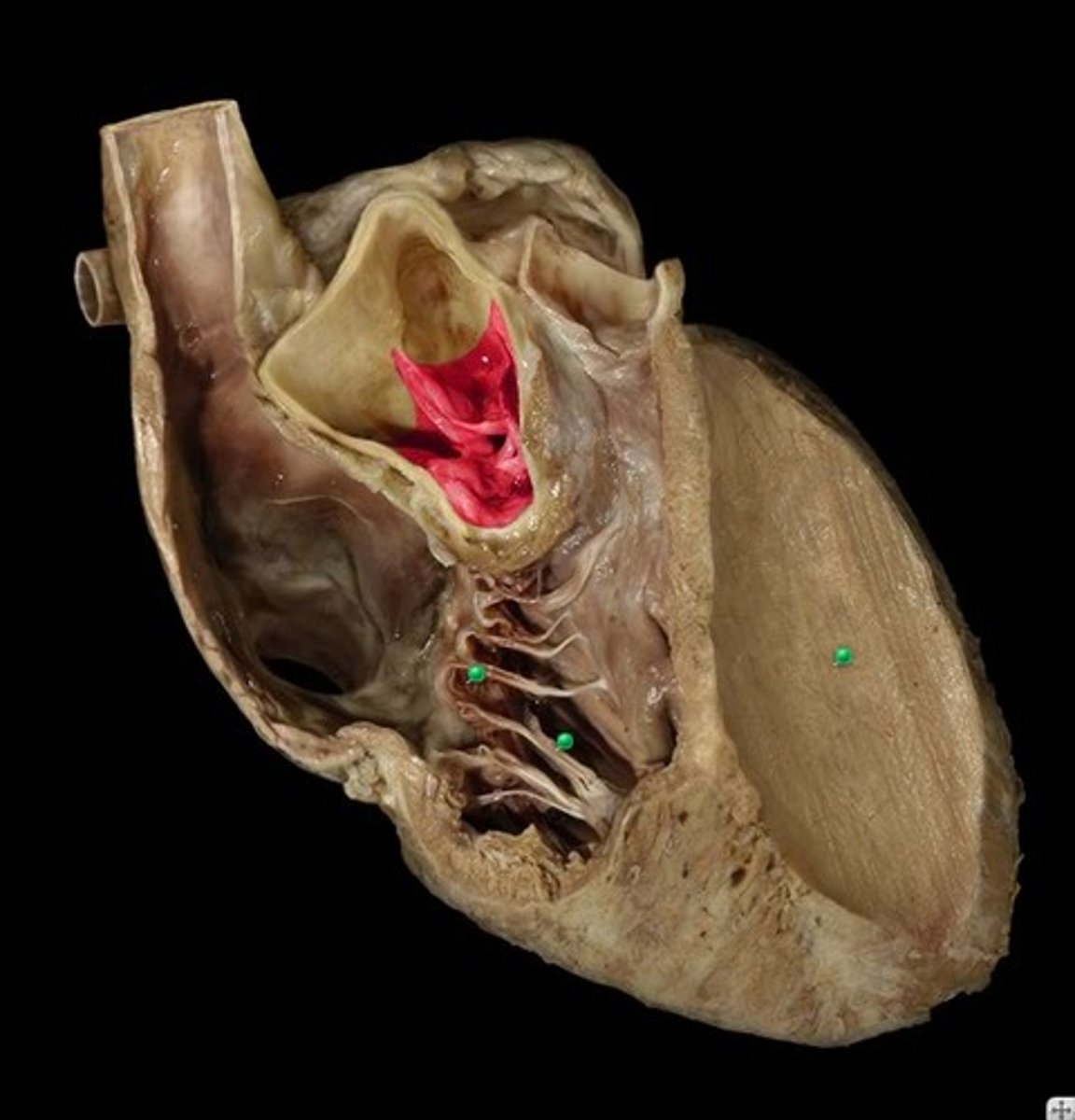 <p>Component; only 1 of the 3 drapes</p>