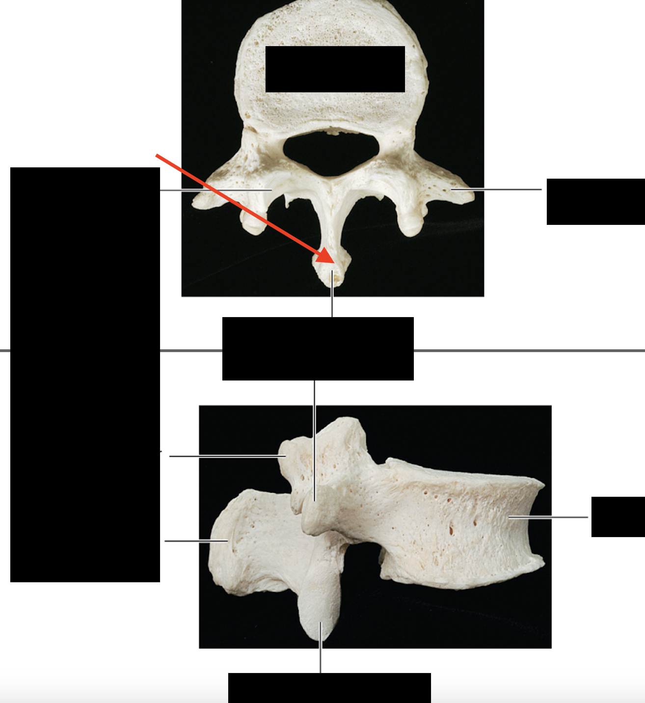 <ul><li><p>thickest of the vertebrae </p></li></ul>