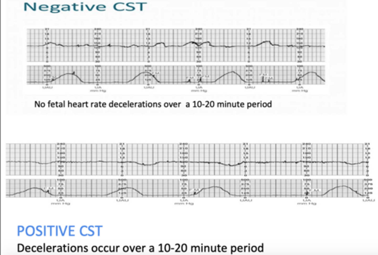 <p>measure response of fetus (FHR) after uterus is stimulated to contract</p><p>ensure that during labour, fetus can handle contractions and get O2 needed from placenta</p><p>nipple- or oxytocin-stimulated contraction test</p><p>negative test: FHR does not show deceleration or late decelerations (GOOD)</p><p>positive test: FHR is showing decelerations and late decelerations (BAD)</p>