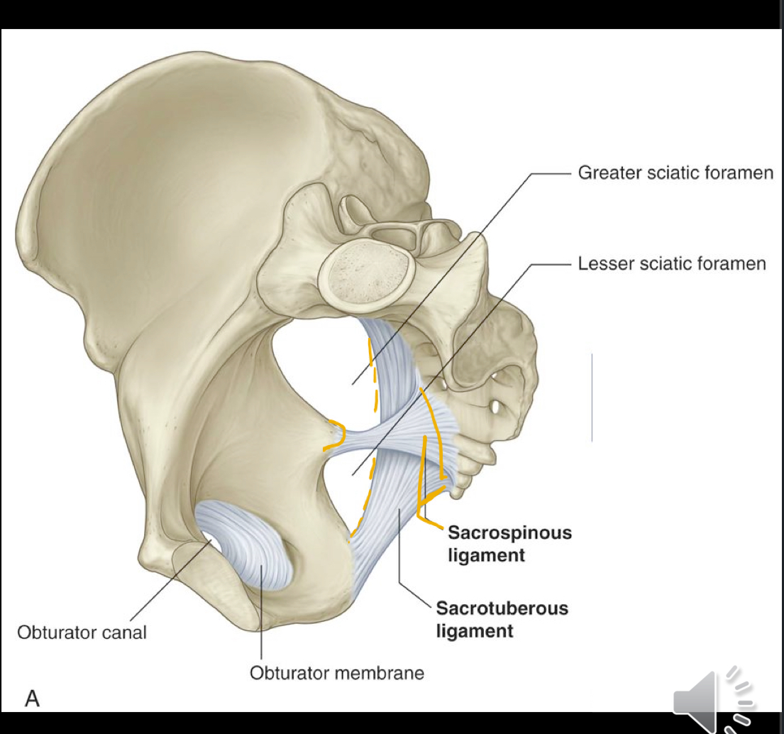 <ul><li><p>Sacrospinous ligaments</p><ul><li><p>Ischial spine to sacrum &amp; coccyx </p></li><li><p>Looks transversely placed (straight across to the sacrum &amp; coccyx)</p></li></ul></li><li><p>Sacrotuberous ligament</p><ul><li><p>Posterior superior iliac spine to ischial tuberosity, providing additional support to the pelvic wall. </p></li><li><p>This one travels in a wave line pattern “)”</p></li></ul></li></ul><p></p>