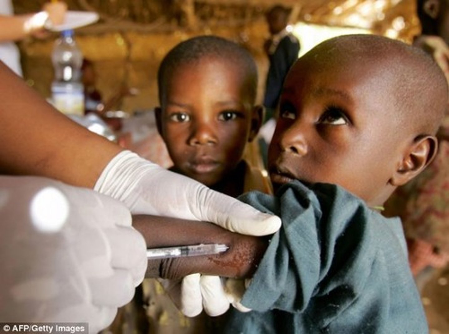 <p>Time during the late 20th countries, when medical technology from Europe and North America diffused to developing countries</p>