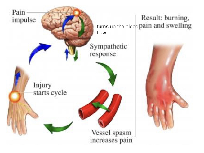 Persists even long after an injury has healed and the pain and disability can worsen over time (mostly a disorder in young women)