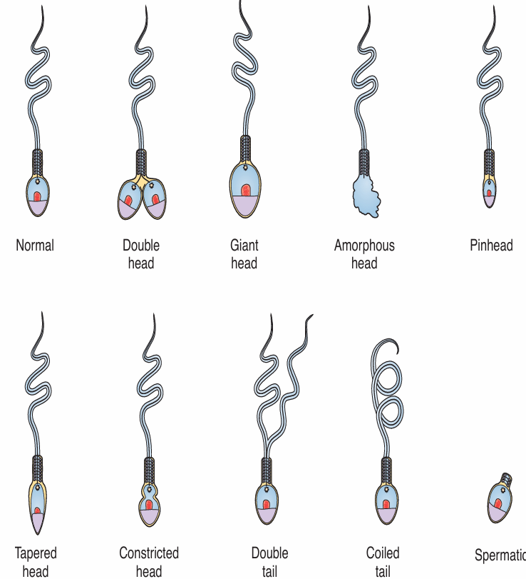 <p>&gt;50% normal forms</p>
