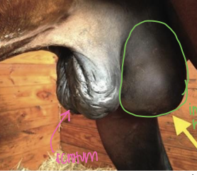 <p>what type of hernia is this?</p>