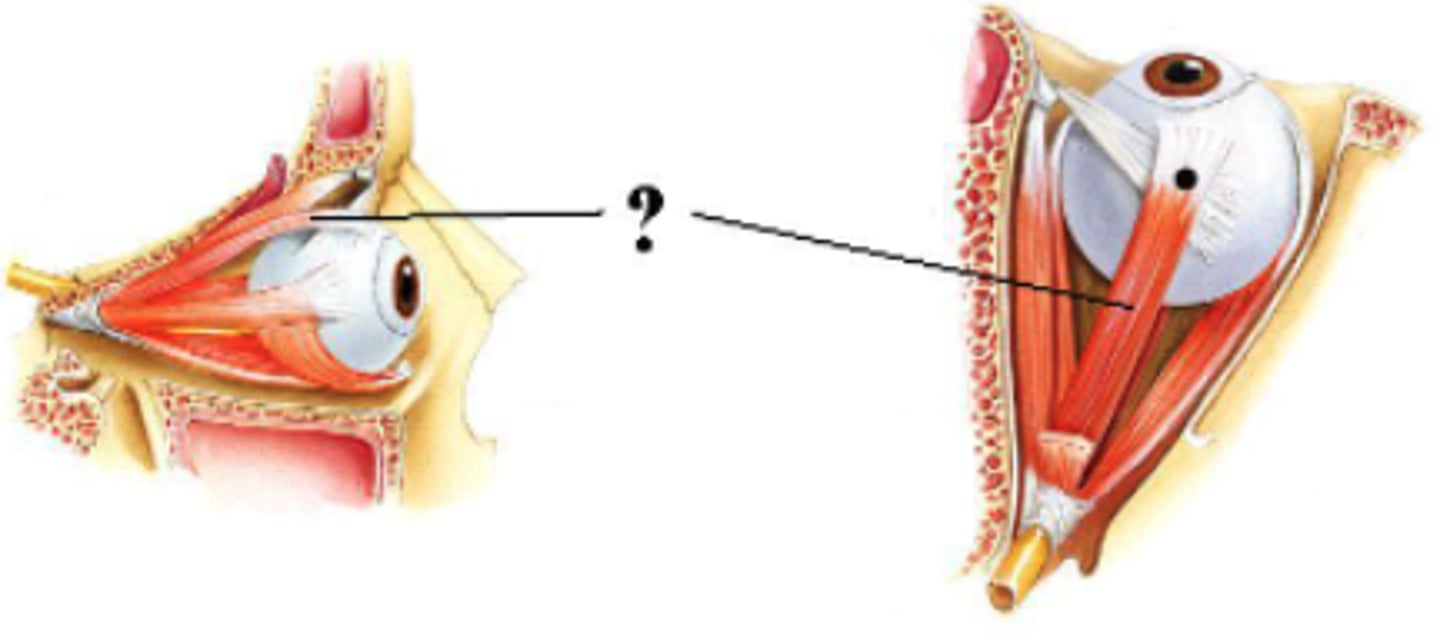 <p>superior rectus muscle</p>