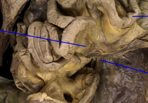 <p>directly attached to the small intestine</p>
