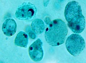 ameboid blastocystis hominis