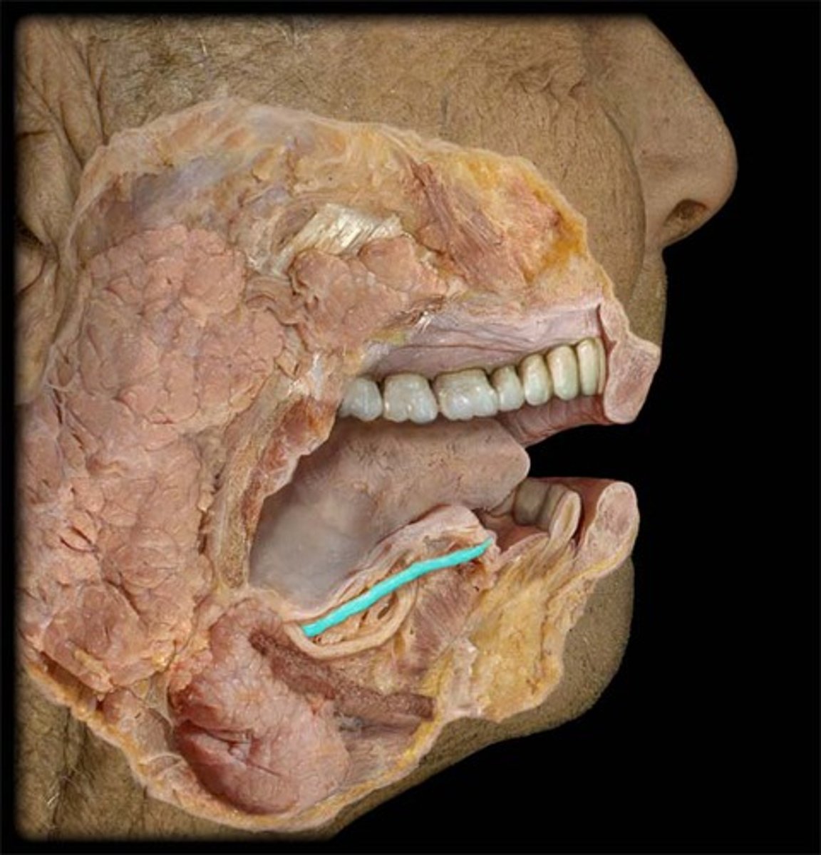 knowt flashcard image