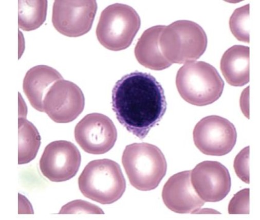 <p>which leukocyte is this?</p>