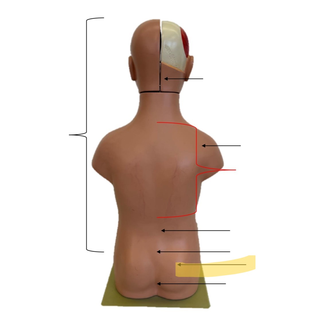 <p>Gluteal</p>
