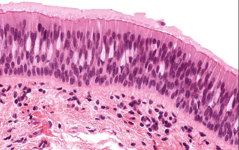 <p>Un sg. strat celule cilindrice, pare mai multe straturi.</p><p><strong>Localizare:</strong></p><p>•<strong><em>Epiteliul ciliat</em></strong>: tapetează căile aeriene mari și sinusurile paranazale – se numește <strong><em>epiteliu respirator</em></strong></p><p>•<strong><em>Epiteliul neciliat</em></strong>: tapetează ductele excretoare mai mari ale glandelor salivare</p>