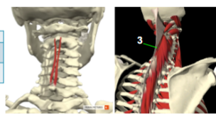 <p><span><span>mm. Spinales cervicis</span></span></p>
