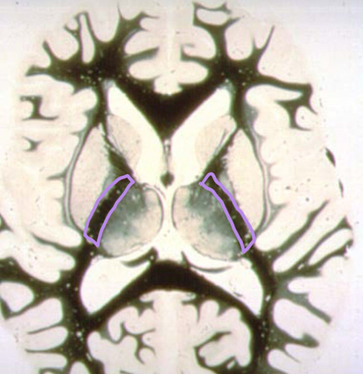 <p>identify the structure</p>