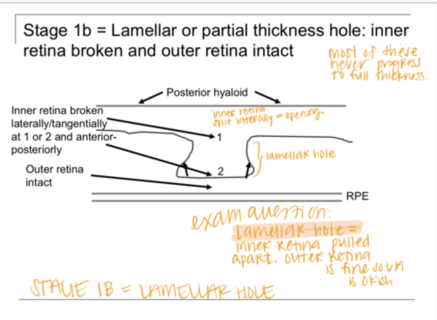 <p>With a lamellar hole, there is _____ separation of the retina, Where?</p>