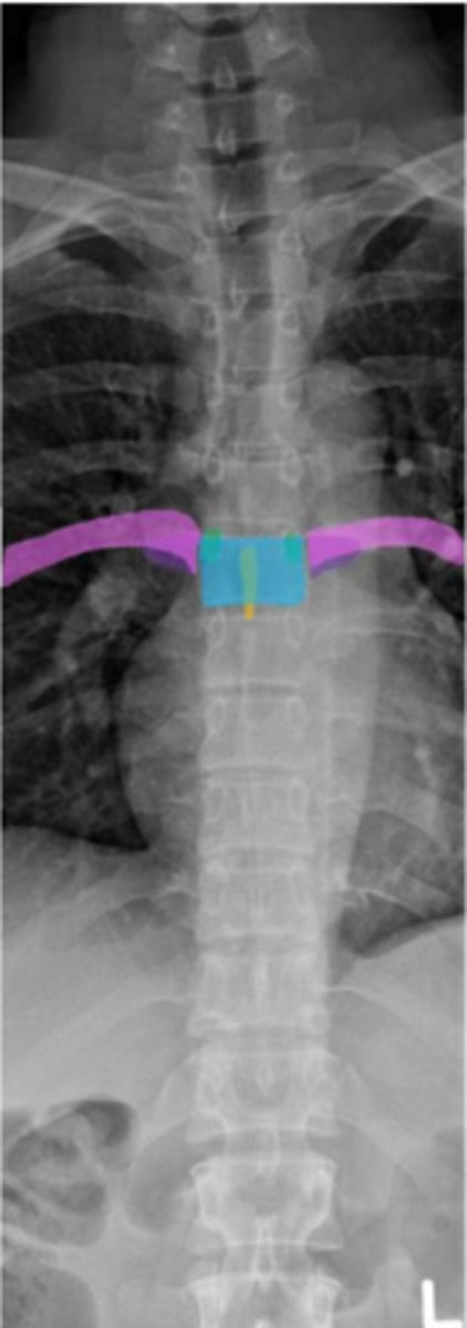 <p>Identify the purple structure</p>