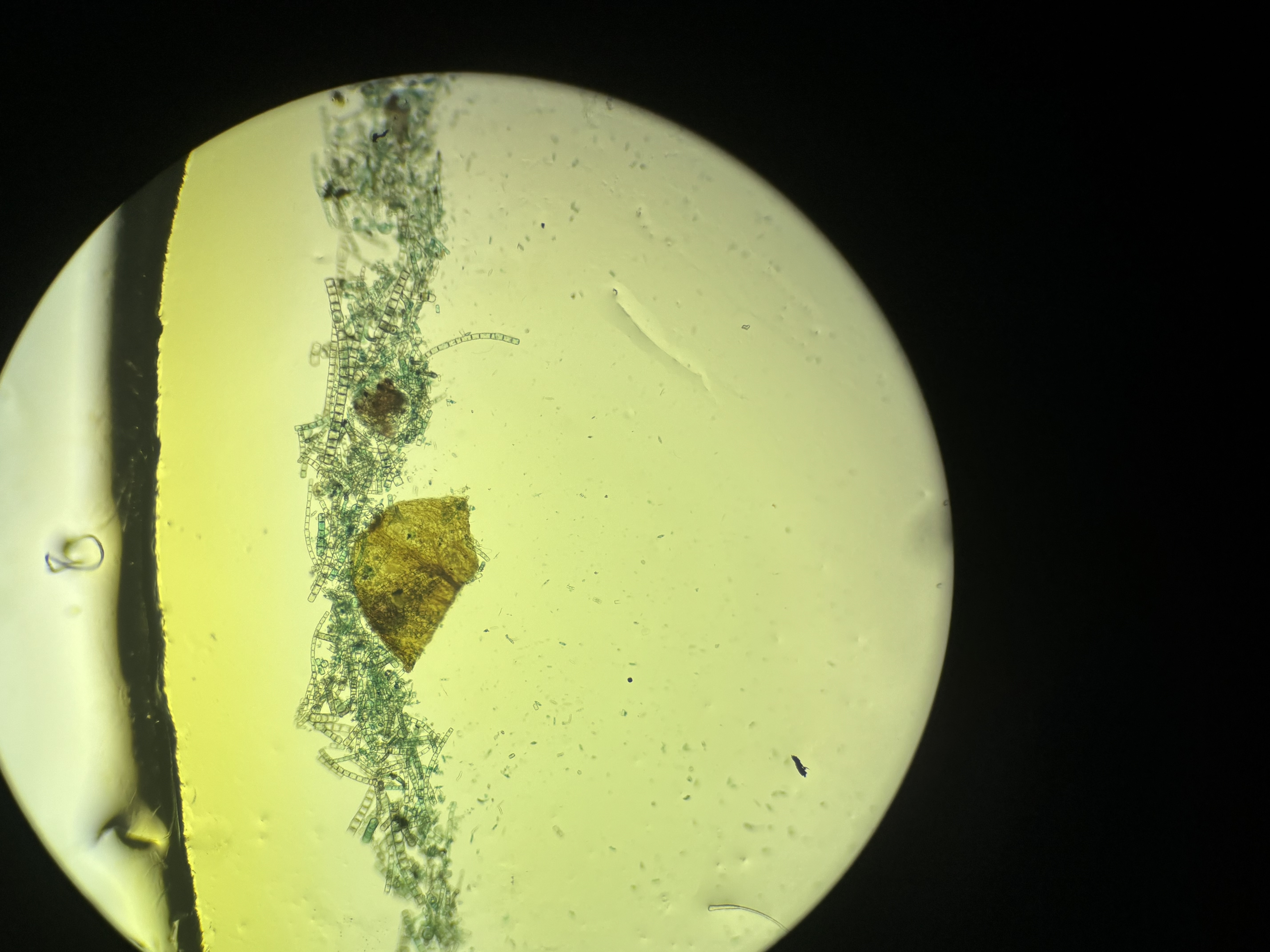 <p>Diatoms: strew of mixed species</p>