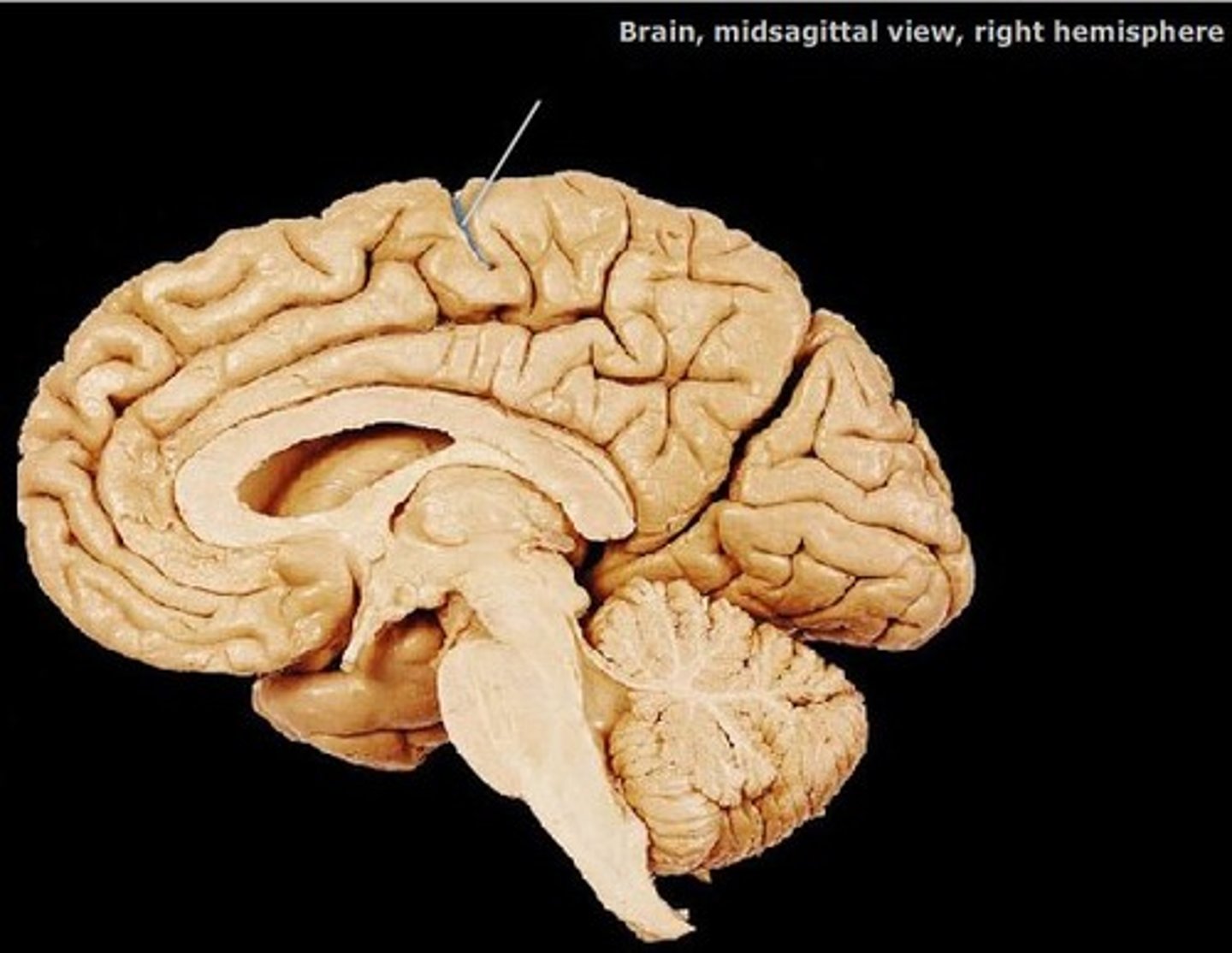 <p>marks the boundary between the frontal+parietal lobes</p>