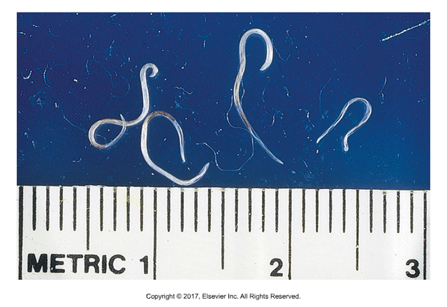 <p>Eyeworm - "Nipple saliva"</p><ul><li><p>Found: In North America​</p></li><li><p>Adults found in conjunctiva and lacrical duct​</p></li><li><p>Larvae passed by face fly, Musca autunmalis​</p></li><li><p>Surgically removed from eye</p></li></ul><p></p>