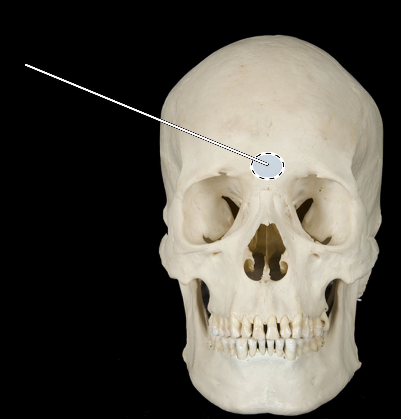 <p>Name the highlighted portion.</p><p>(Skull, anterior view).</p>