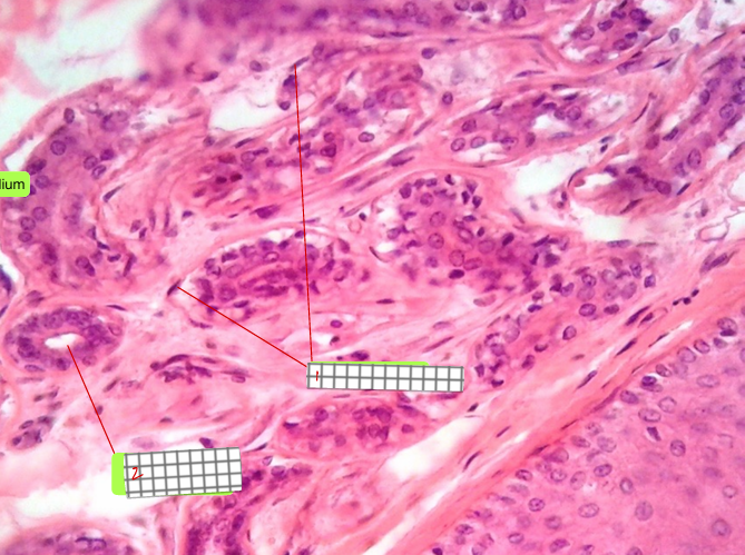 <p>specimen<br>type of section:<br><br>label</p>