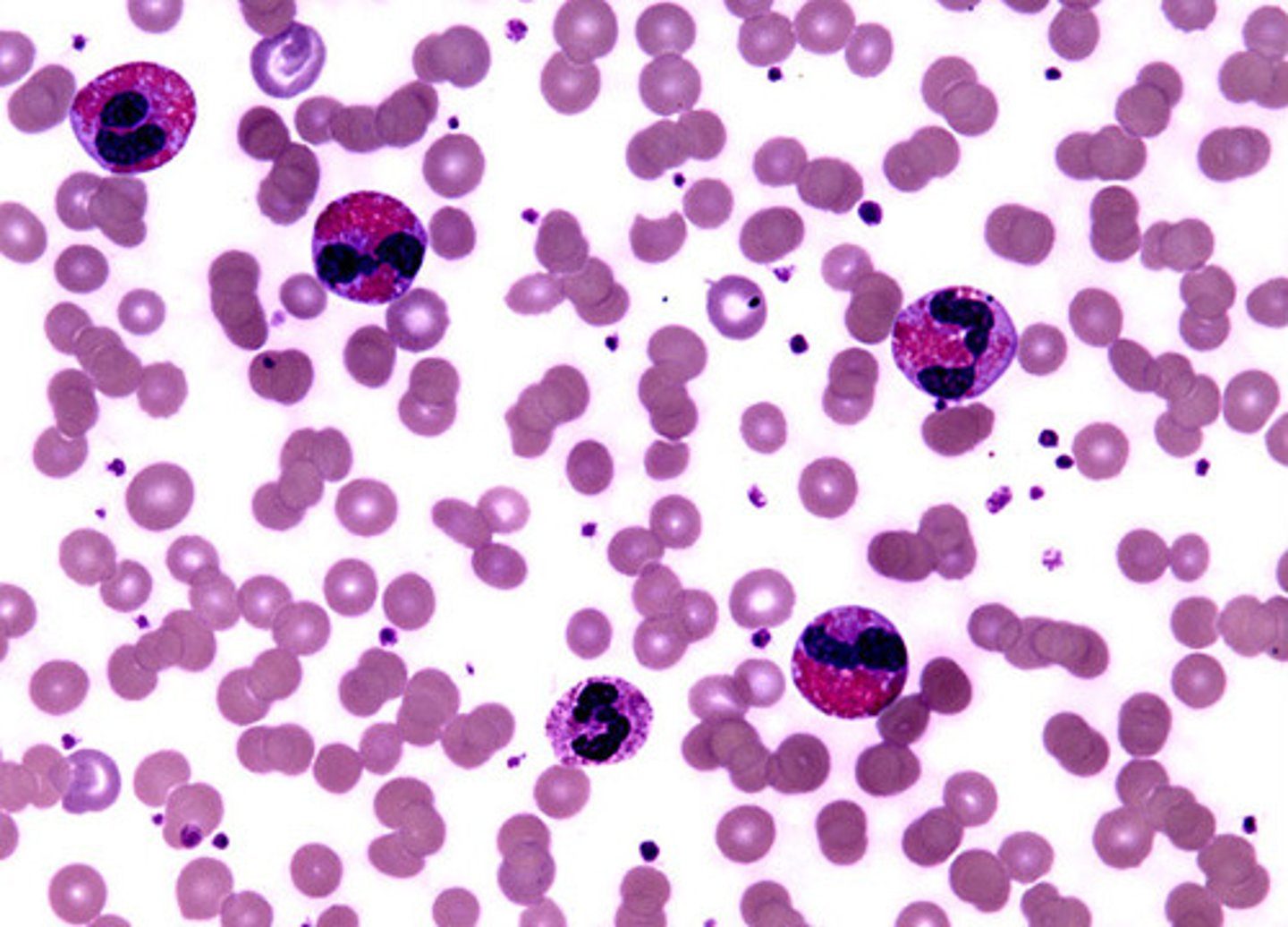 <p>increase in eosinophils</p>