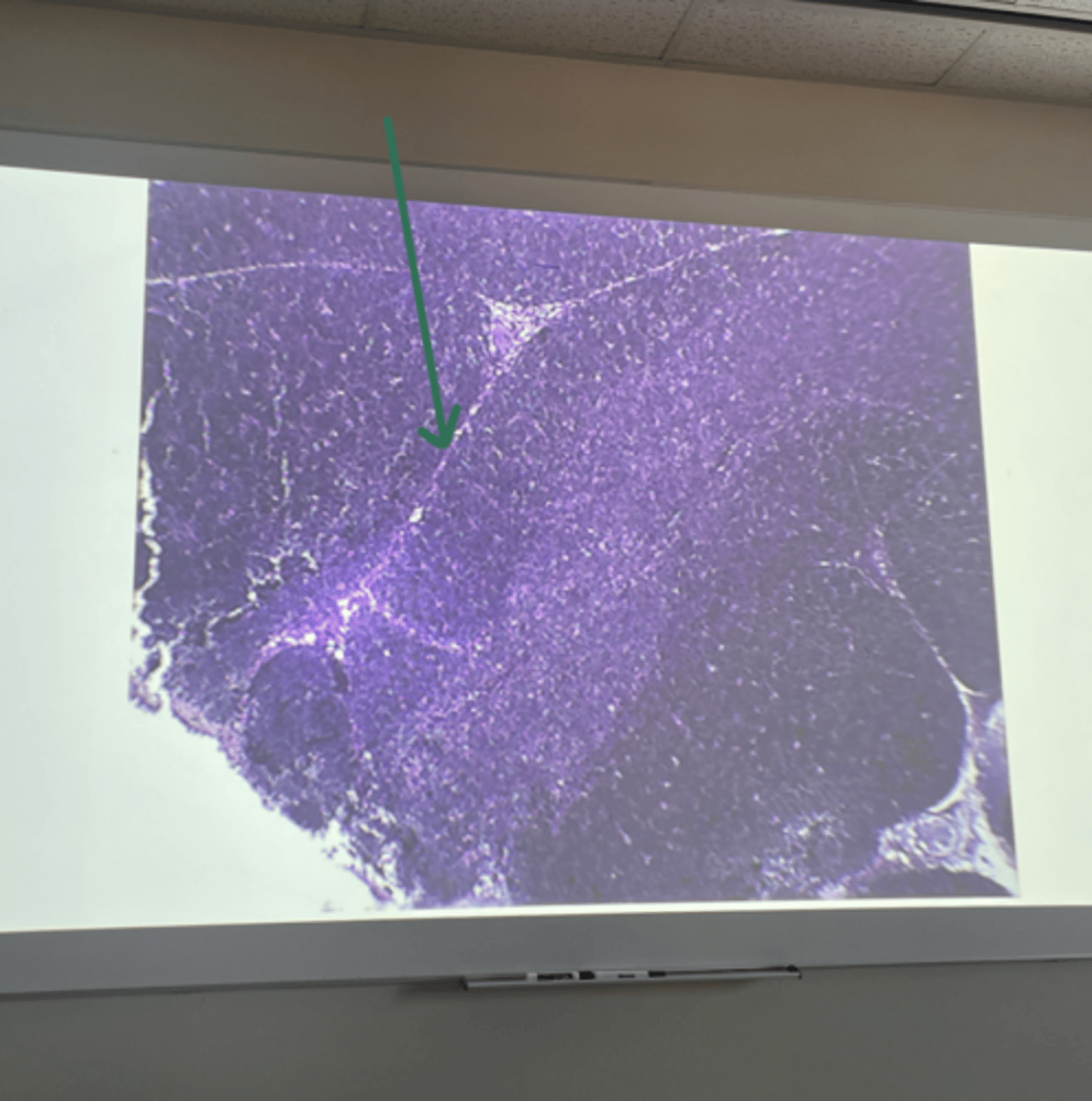 <p>gland and structure</p>