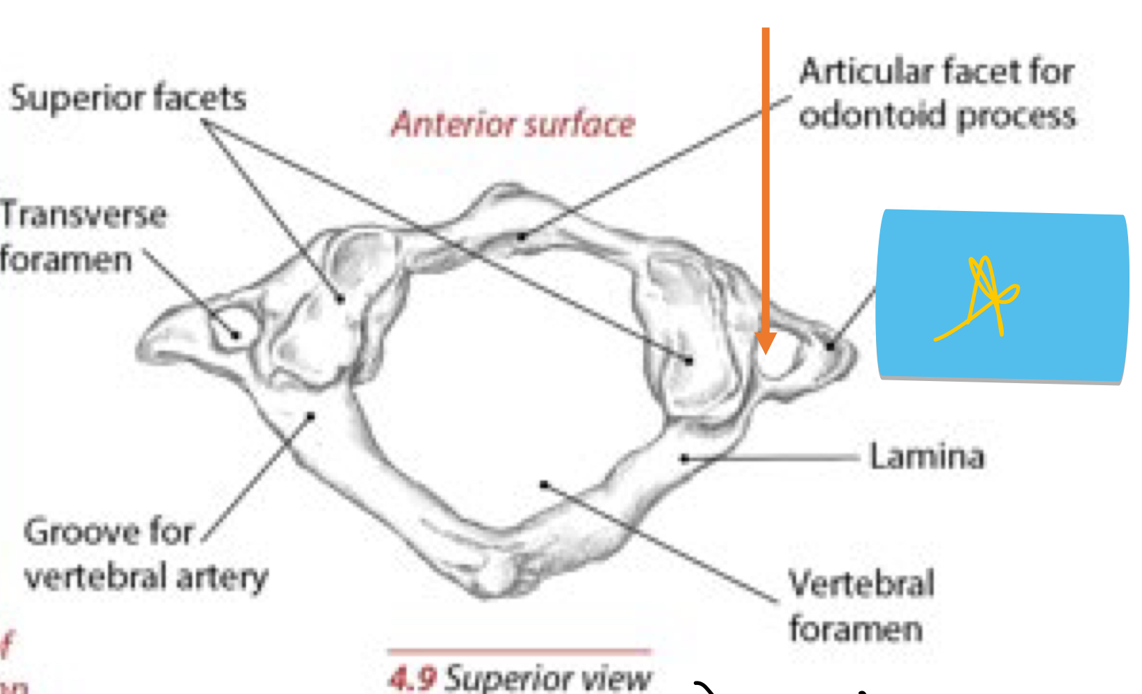 <p>Identify this structure and anatomical significance (yellow star)</p>