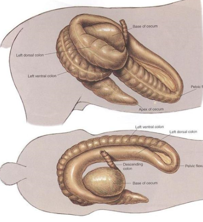 <ul><li><p><span style="background-color: transparent;"><strong>Left → can move freely “floating colon”</strong></span></p><ul><li><p><span style="background-color: transparent;"><strong>Et:</strong> <u>Colon trapped between </u></span><span style="background-color: transparent; color: red;"><u>spleen & left kidney, nephrosplenic lig.</u></span></p><ul><li><p><u>Non-strangulating </u></p></li></ul></li><li><p><span style="background-color: transparent;"><strong>Cs:</strong> <u>mild pain</u></span></p></li><li><p><span style="background-color: transparent;"><strong>Dt: </strong><u>rectal exam</u>, US</span></p></li><li><p><span style="background-color: transparent;"><strong>Tx:</strong> <u>rolling</u>, phenylephrine, </span><span style="background-color: transparent; color: red;">controlled exercise, Sx</span></p></li></ul></li><li><p><span style="background-color: transparent;"><strong>Right</strong></span></p><ul><li><p><span style="background-color: transparent;"><strong>Et: </strong><u>Colon wrapped around cecum, displaced to right body wall</u></span></p><ul><li><p>Non-strangulating</p></li></ul></li><li><p><span style="background-color: transparent;"><strong>Cs:</strong> Progressive pain, distention, </span><span style="background-color: transparent; color: red;">cardiovascular compermise </span></p></li><li><p><span style="background-color: transparent;"><strong>Dt: </strong></span><span style="background-color: transparent; color: red;">rectal exam, US</span></p></li><li><p><span style="background-color: transparent;"><strong>Tx: </strong></span><span style="background-color: transparent; color: red;">Sx</span></p></li></ul></li></ul><p></p>