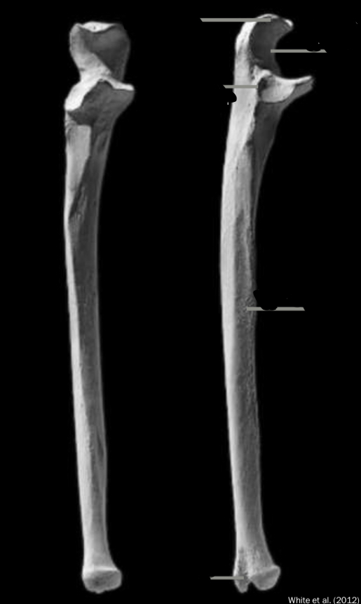 <p>Identify the trochlear notch</p>