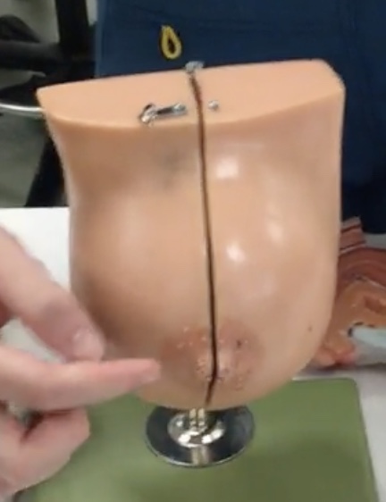 <p>Description: Pigmented skin surrounding the nipple</p><p>Relationship: N/A</p>