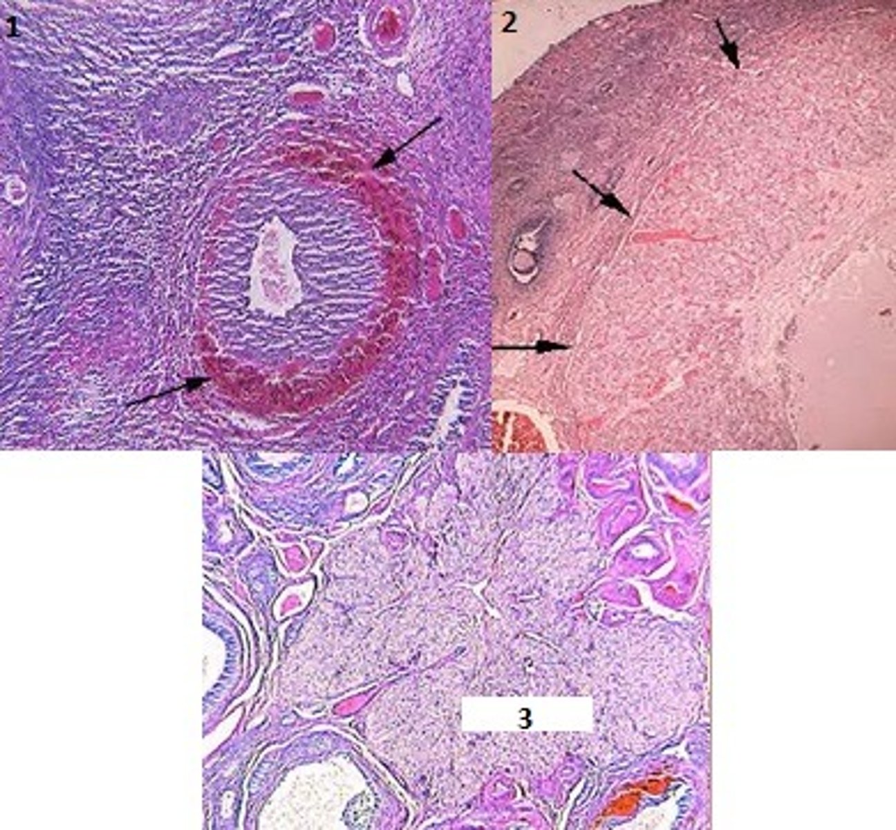 <p>Identify the step 1 - 3 that occur after ovulation</p>